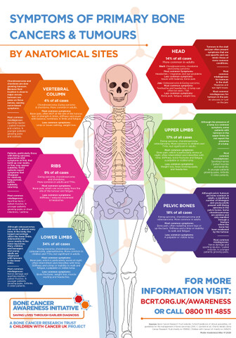 Bone cancer on the skull: Symptoms and more